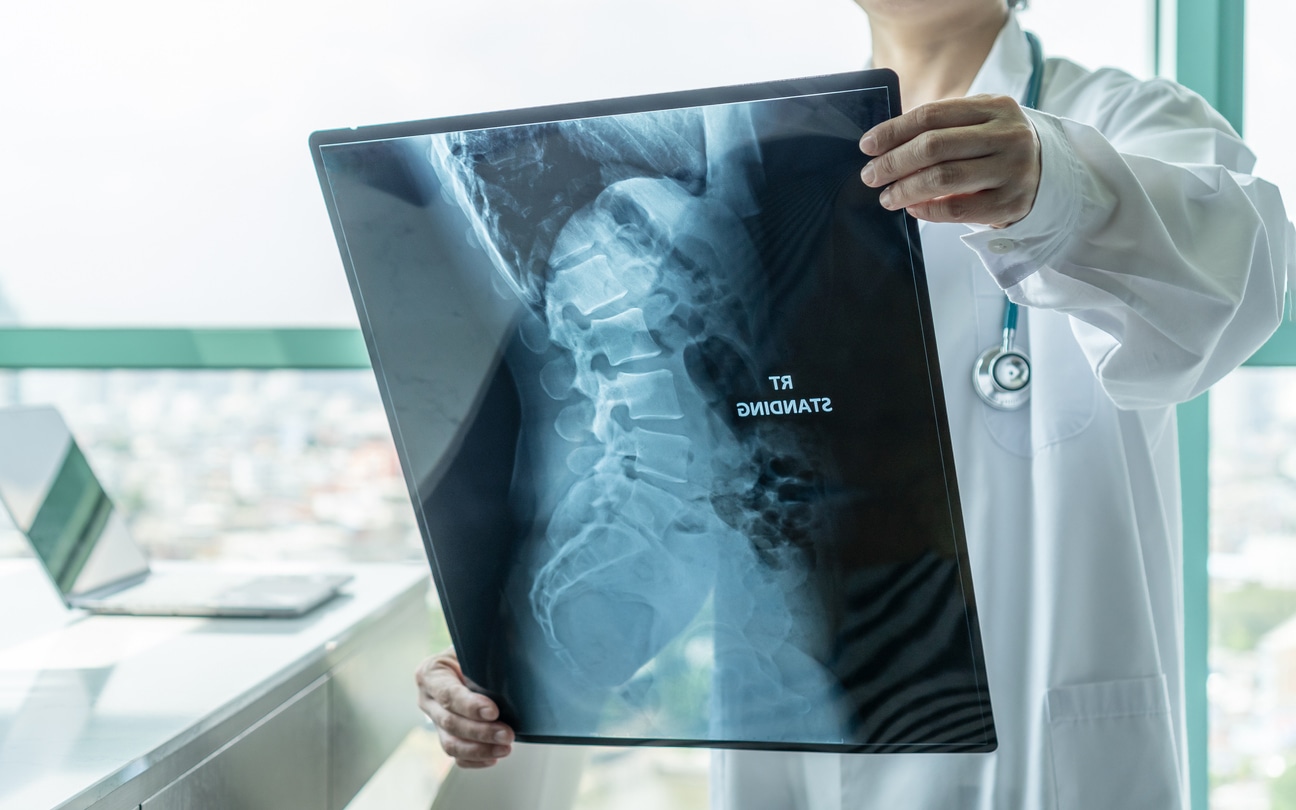 Spinal Disc Extrusion and Protrusion After a Texas Accident