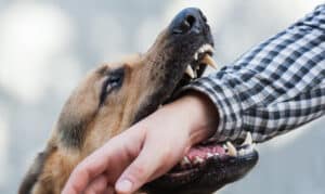 How Attorney Brian White Personal Injury Lawyers Can Help After a Dog Bite in Clear Lake