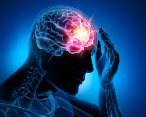 Why Choose Attorney Brian White Personal Injury Lawyers to Help After You’ve Suffered a Brain Injury in Cypress, TX