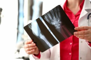 Doctor holding x-rays